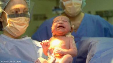 لماذا زادت معدلات الولادة القيصرية في الولايات المتحدة؟